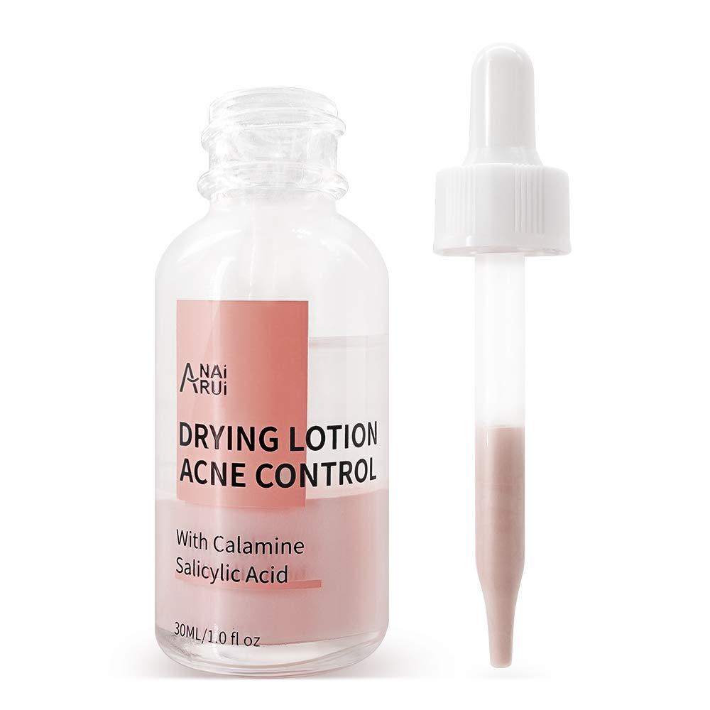 Drying Lotion Acne Control 