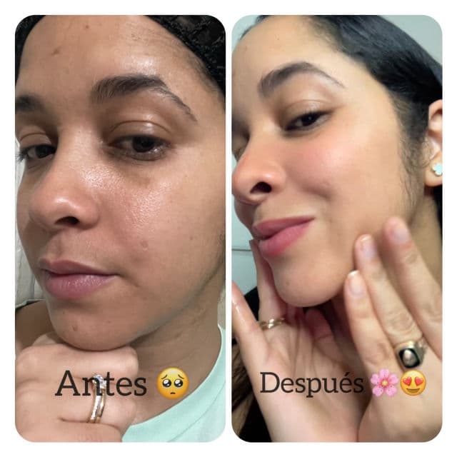 EUNYUL Ring Collagen 20 Return Serum review photo by caroaquinov