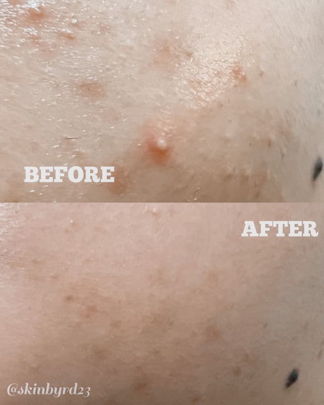 TATA GALTIER Bertine Moisturising Gel Cream review photo by Skinbyrd