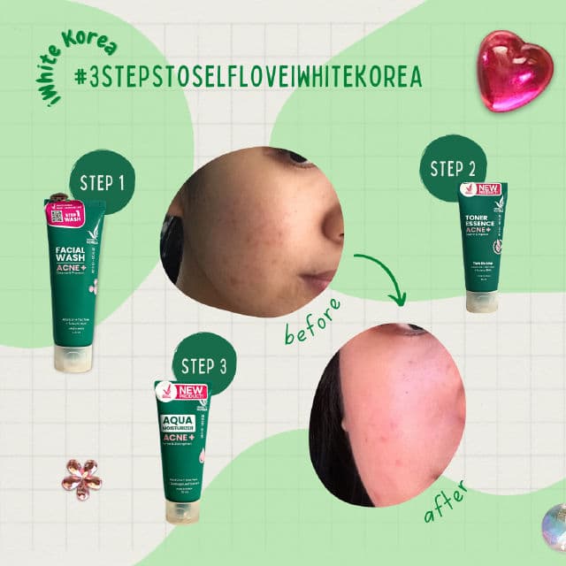 Acne+ Facial Wash product review