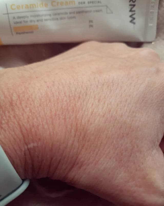 RNW Der. Special Ceramide Cream review photo by silviabaloo75