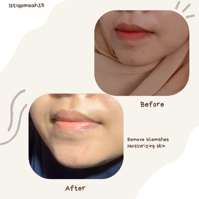 SKINBAE Advance Brightening Serum review photo by Istiqomah