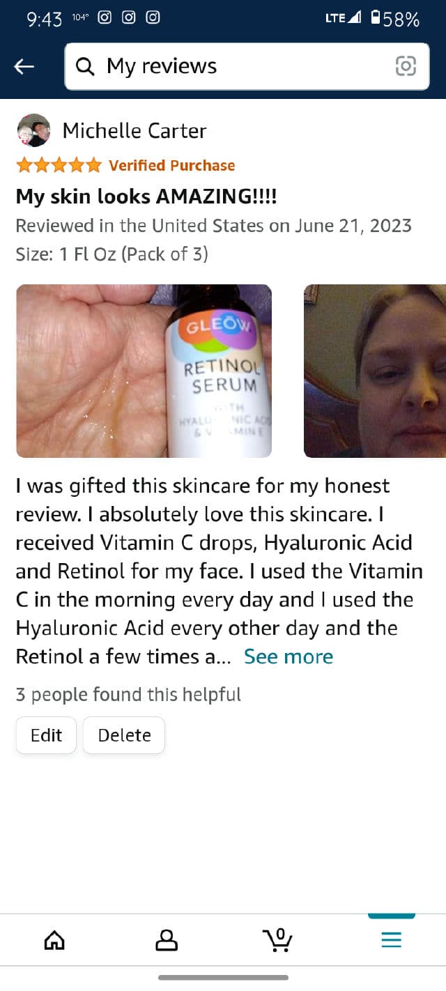 GLEOW Retinol Serum review photo by Michelle75