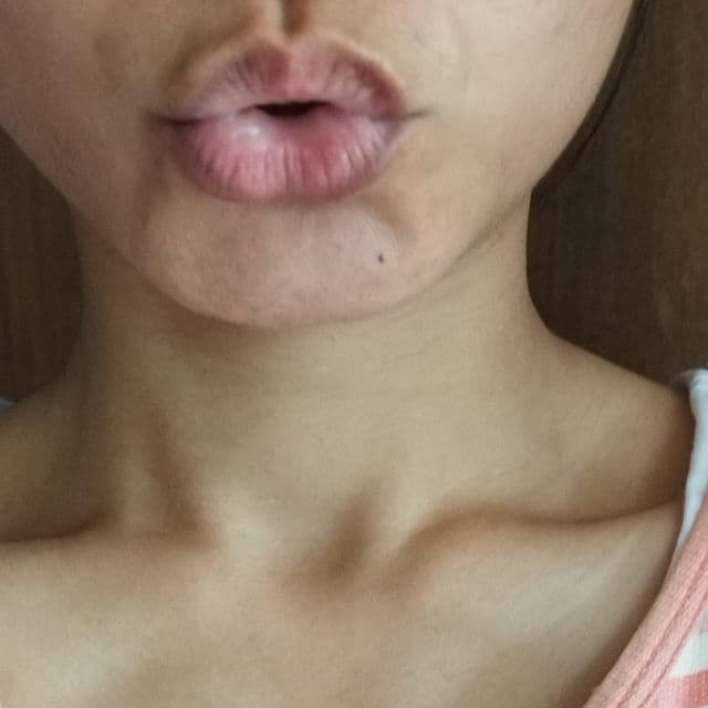 OMI Menturm Deepner Lip Balm - Sensitive review photo by insanelysirius