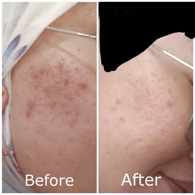 Ruruberry 10% Niacinamide + Zinc review photo by Jamalia