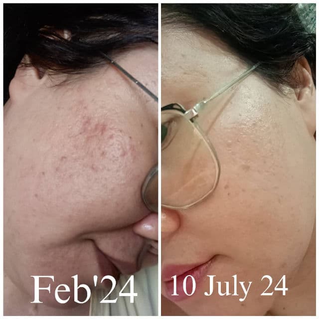 Hollaface Pore-Clarifying Brightening Serum (Blueprint Edition) review photo by Jamalia