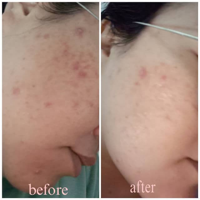 Minimalist Polyhydroxy Acid (PHA) 03% Toner review photo by Jamalia