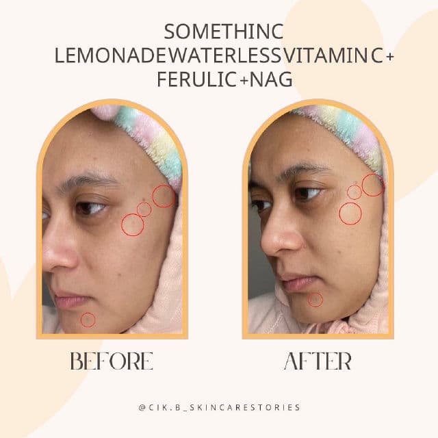 Somethinc Lemonade Waterless Vitamin C + Ferulic + NAG review photo by cikbskincarestories