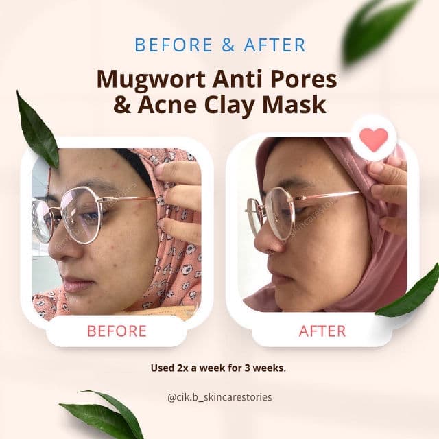 Skintific Mugwort Anti Pores & Acne Clay Mask review photo by cikbskincarestories