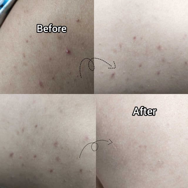 Glutanex AHA BHA LHA Toner Pad review photo by Ichie0613