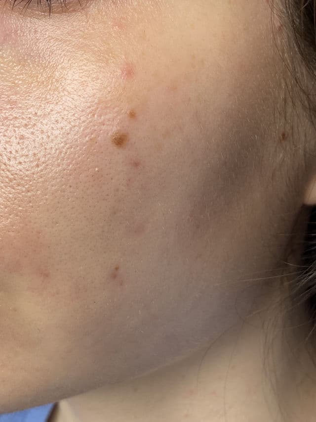 Naturium Alpha Arbutin Serum 2% review photo by andrarmua