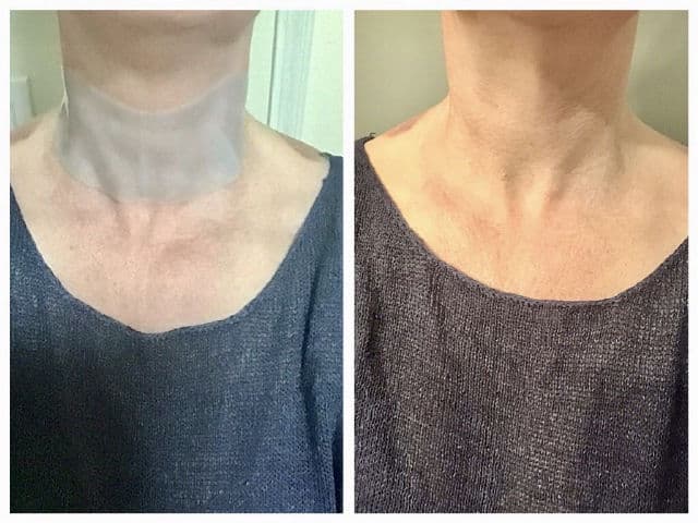 Dr. Ceuracle Hyal Reyouth Hydrogel Neck Mask review photo by remedyforbeauty