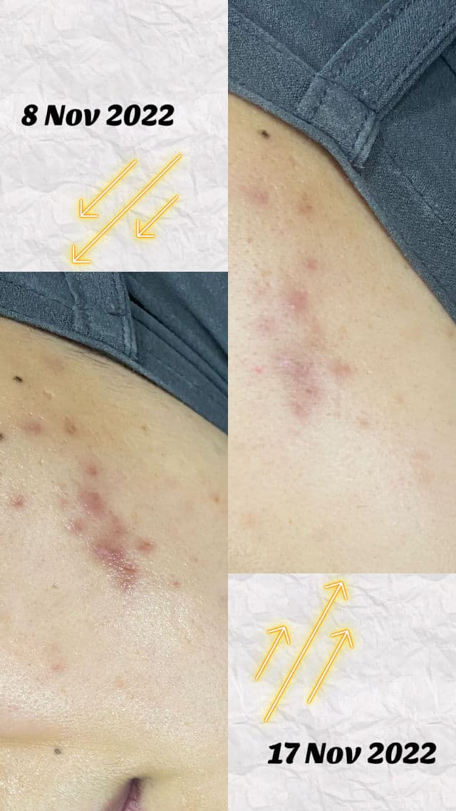 Reset The Skin 10% Niacinamide + 2% Alpha Arbutin Brightening Serum review photo by JuliaAlly