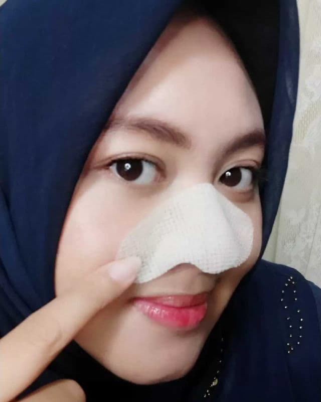 One-day's you P.Z. Ssoc Ssoc No More Blackhead review photo by lilprincess