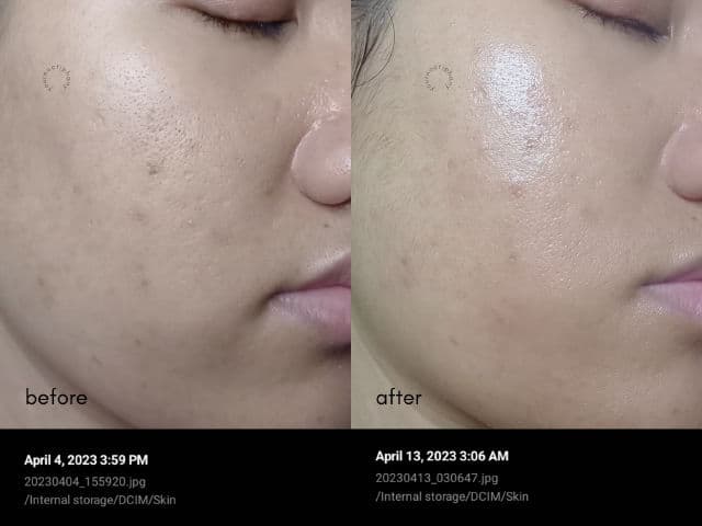 Azarine Retinol Complex + 5x Ceramide Mighty Serum review photo by yournoctiphany