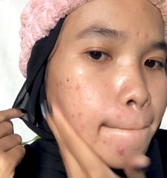 Kojie San Face Lightening Cream review photo by bilabila