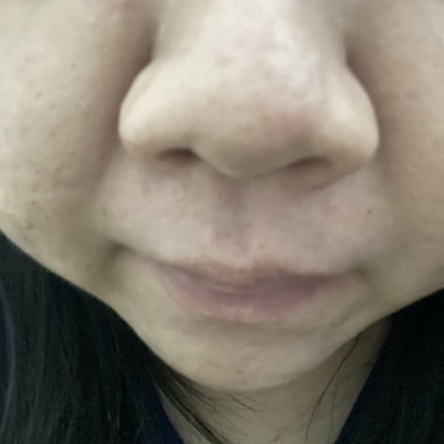 CNP Laboratory Anti-Pore Blackhead Clear Kit - Mask 1: Black Head Clear Mask review photo by Sushen