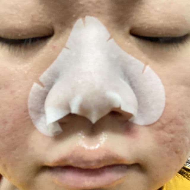 Mary&May Daily Safe Black Head Clear Nose Mask (Step 2) review photo by Sushen