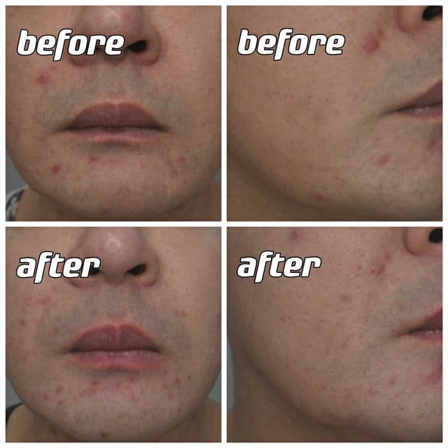 4PM Low pH Galactomyces Niacinamide Gel Cleanser review photo by danielwonderland