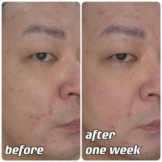 MIXSOON Bean Essence review photo by danielwonderland