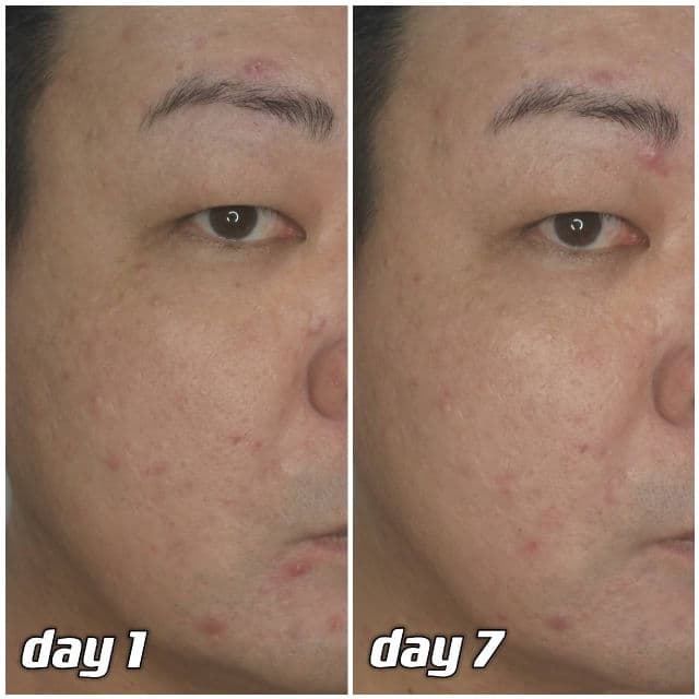 The History of Whoo Royal Regina Energetic Repair Serum review photo by danielwonderland