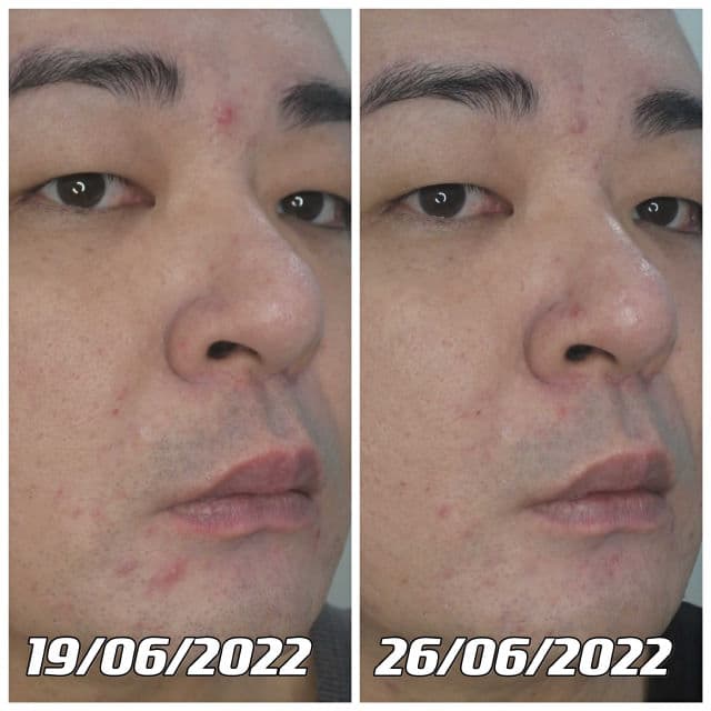 Pureforet Centella Cica Toner Pads  review photo by danielwonderland