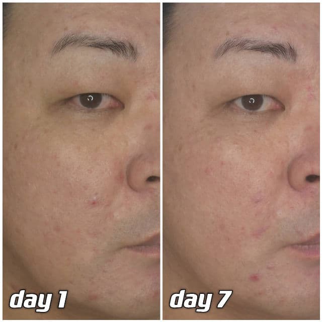 Pyunkang Yul Ultimate Calming Solution Toner review photo by danielwonderland