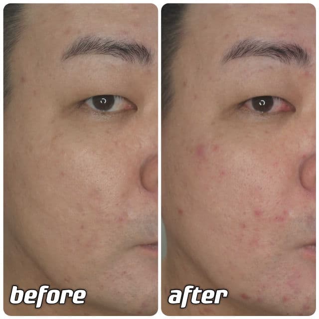 RAVIEL Multi Vitamin Dark Spot & Blemish Care Face Serum review photo by danielwonderland