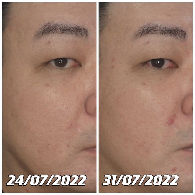 Miguhara Green Tea Calming Essence Cream - Origin review photo by danielwonderland