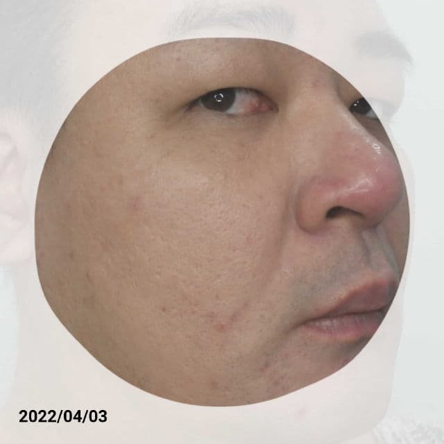 Ruruberry 18% Ethyl Ascorbic Acid Booster Drop review photo by danielwonderland