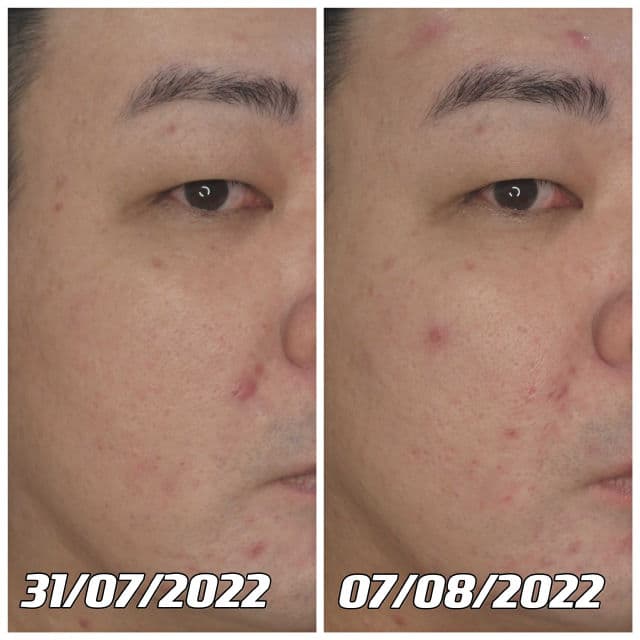 4PM Low pH Galactomyces Niacinamide Gel Cleanser review photo by danielwonderland