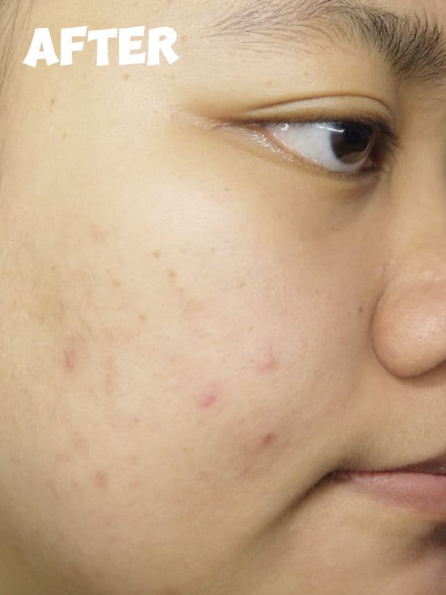 Wellage Real Hyaluronic Blue 100 Ampoule review photo by farahaszar