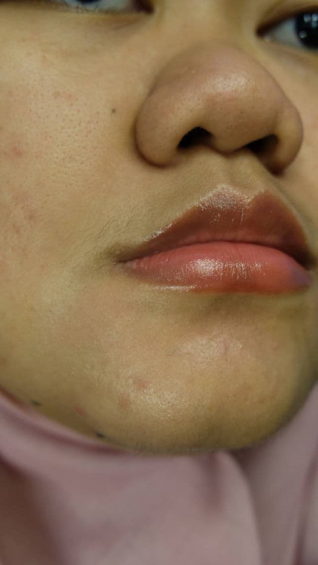 ElsheSkin Barrier+ pH Balance Jelly Cleanser review photo by farahaszar