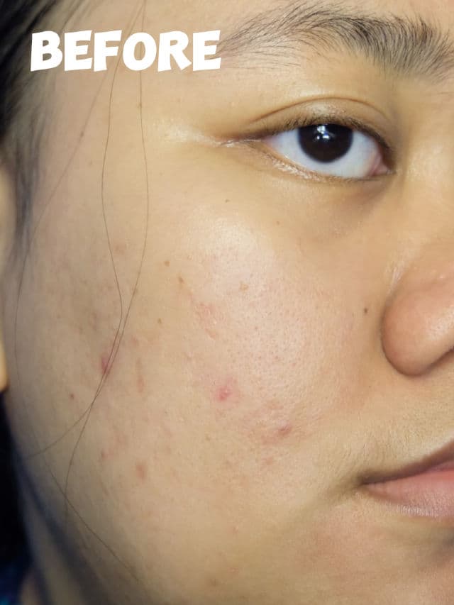 Wellage Real Hyaluronic Blue 100 Ampoule review photo by farahaszar