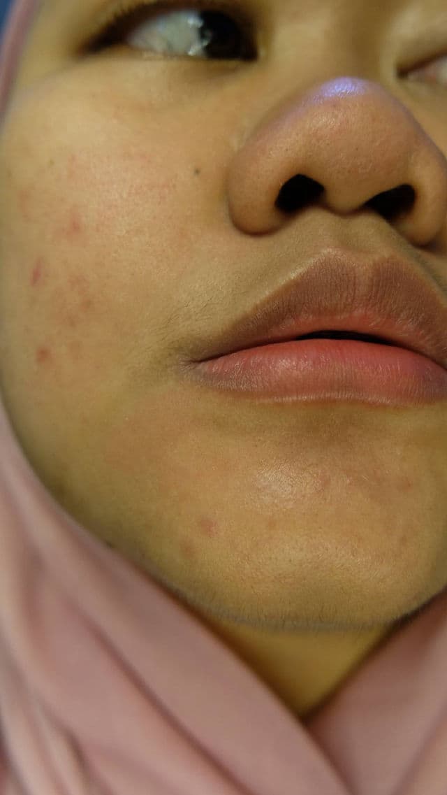 ElsheSkin Barrier+ pH Balance Jelly Cleanser review photo by farahaszar