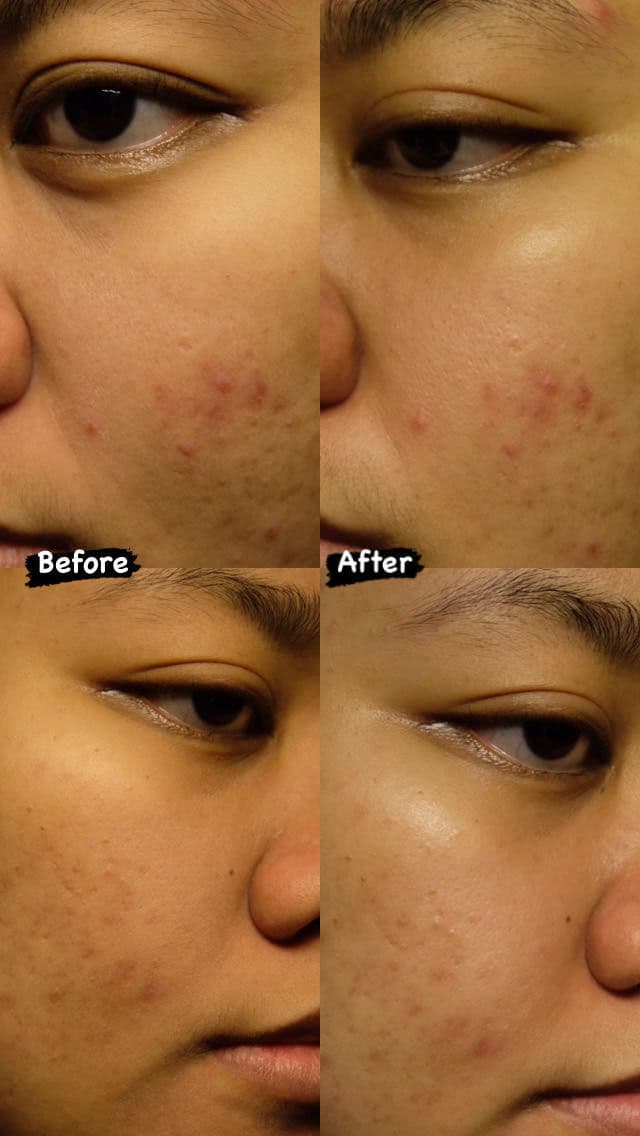 ACWELL Licorice pH Balancing Cleansing Toner review photo by farahaszar