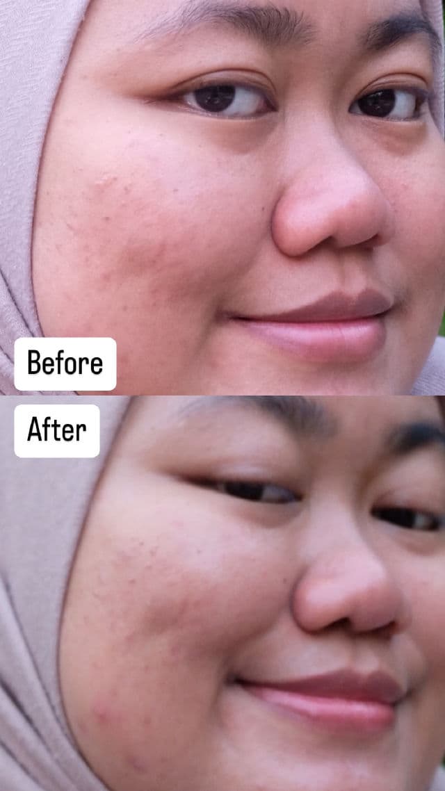 I'M FROM Rice Toner Pad review photo by farahaszar