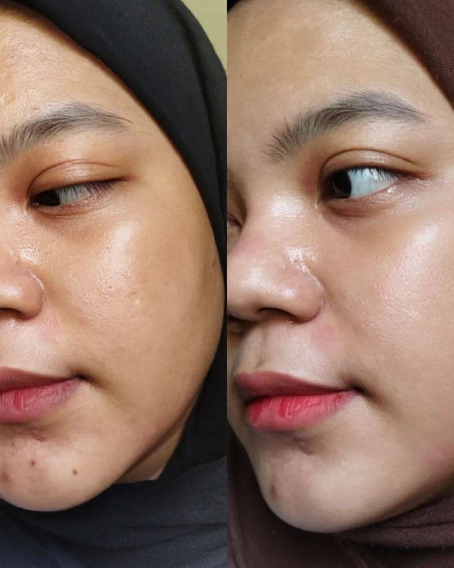 ElsheSkin Radiant Skin Serum review photo by Fairuzamirahrazak