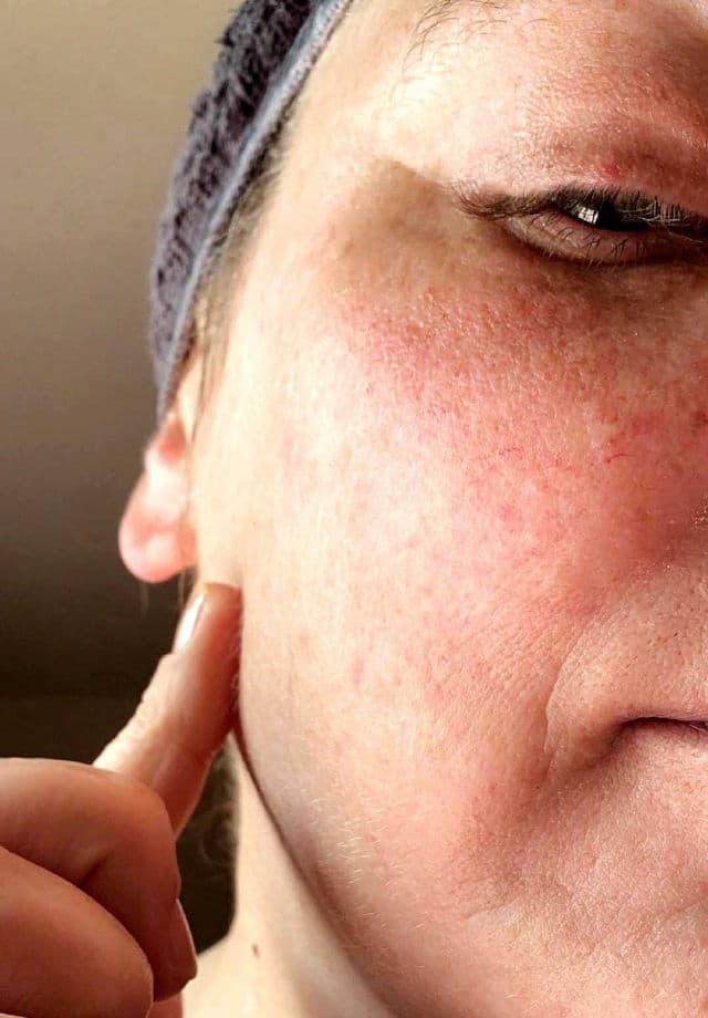 DEW of the GODS Claydate Healing Mask review photo by SarriK