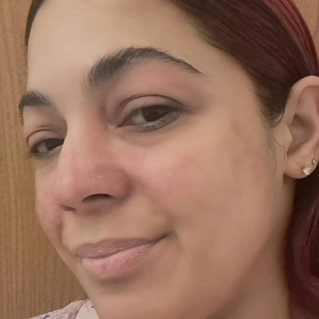 Red Blemish Clear Soothing Cream product review