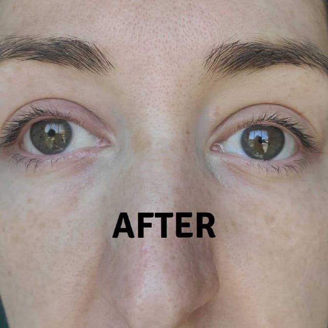 NeoStrata Hydra Filling Eye Gel-Cream review photo by canadianskincare