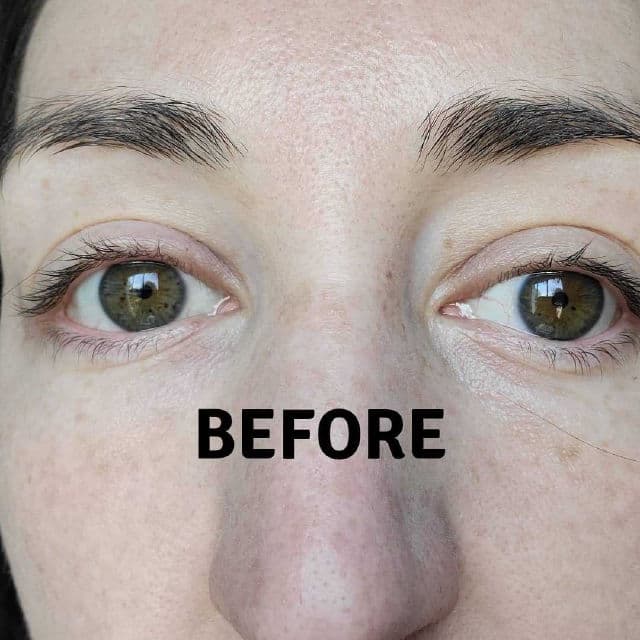 NeoStrata Hydra Filling Eye Gel-Cream review photo by canadianskincare