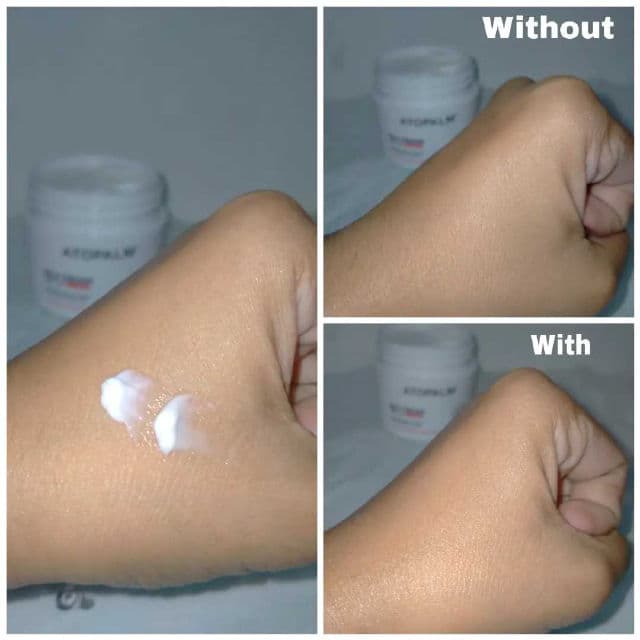 Atopalm MLE Cream review photo by skinbykattryn