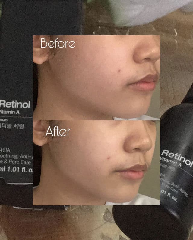 The Potions Retinol Serum  review photo by shaooo