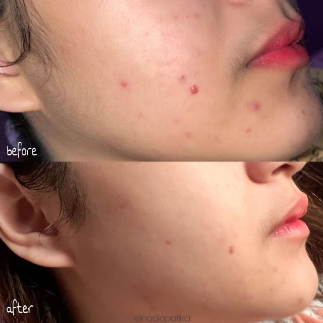 Somethinc Resurrect Multibiome Serum review photo by nddey