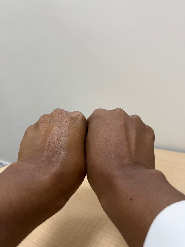 Frameless Pure Vitamin C 20% Element product review