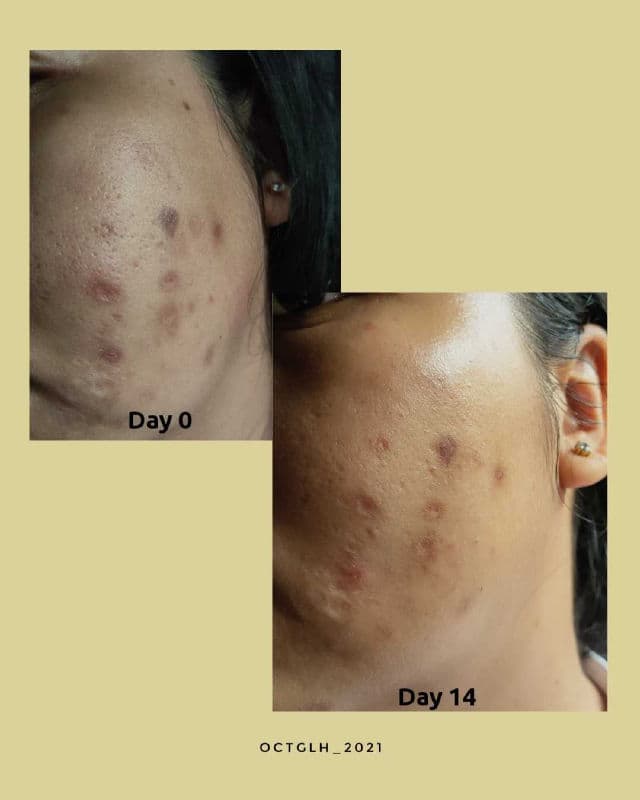 OASEA Oceanus Squalane + Tranexamic Spot Correcting Face Oil Serum review photo by OctaGaluh