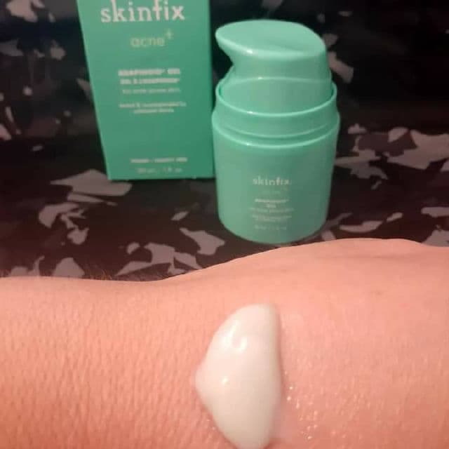 Skinfix Acne+ Adapinoid Gel with Niacinamide + Squalene review photo by Carmen559c