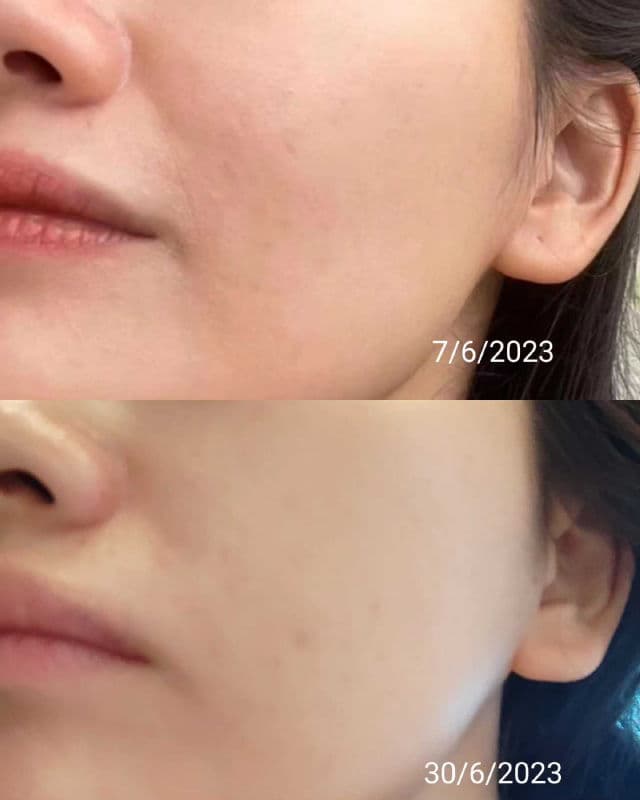 ACWELL Licorice pH Balancing Cleansing Toner review photo by maypiing