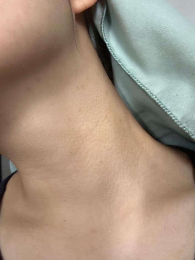 DR Dermis Gentle Relief Cream review photo by maypiing